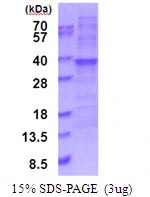 3microg Human RPL7A protein (GTX67757-pro) by SDS-PAGE under reducing condition and visualized by coomassie blue stain. 3microg Human RPL7A protein (GTX67757-pro) by SDS-PAGE under reducing condition and visualized by coomassie blue stain.