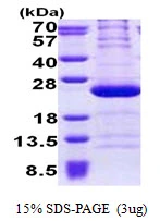 3microg Human RPL11 protein (GTX67759-pro) by SDS-PAGE under reducing condition and visualized by coomassie blue stain. 3microg Human RPL11 protein (GTX67759-pro) by SDS-PAGE under reducing condition and visualized by coomassie blue stain.