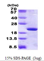 3microg Human RPL12 protein (GTX67760-pro) by SDS-PAGE under reducing condition and visualized by coomassie blue stain. 3microg Human RPL12 protein (GTX67760-pro) by SDS-PAGE under reducing condition and visualized by coomassie blue stain.