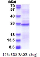 3microg Human RPL18A protein (GTX67761-pro) by SDS-PAGE under reducing condition and visualized by coomassie blue stain. 3microg Human RPL18A protein (GTX67761-pro) by SDS-PAGE under reducing condition and visualized by coomassie blue stain.