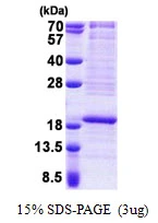 3microg Human RPL22 protein (GTX67762-pro) by SDS-PAGE under reducing condition and visualized by coomassie blue stain. 3microg Human RPL22 protein (GTX67762-pro) by SDS-PAGE under reducing condition and visualized by coomassie blue stain.