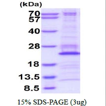 3microg Human RPL26 protein (GTX67764-pro) by SDS-PAGE under reducing condition and visualized by coomassie blue stain. 3microg Human RPL26 protein (GTX67764-pro) by SDS-PAGE under reducing condition and visualized by coomassie blue stain.