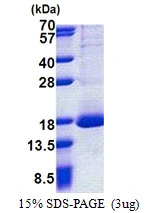 3microg Human RPL30 protein (GTX67765-pro) by SDS-PAGE under reducing condition and visualized by coomassie blue stain. 3microg Human RPL30 protein (GTX67765-pro) by SDS-PAGE under reducing condition and visualized by coomassie blue stain.