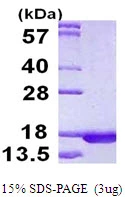 3microg Human RPLP2 protein (GTX67769-pro) by SDS-PAGE under reducing condition and visualized by coomassie blue stain. 3microg Human RPLP2 protein (GTX67769-pro) by SDS-PAGE under reducing condition and visualized by coomassie blue stain.