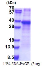 3microg Human RPS2 protein (GTX67770-pro) by SDS-PAGE under reducing condition and visualized by coomassie blue stain. 3microg Human RPS2 protein (GTX67770-pro) by SDS-PAGE under reducing condition and visualized by coomassie blue stain.