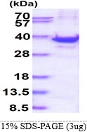 3microg Human RPS3A protein (GTX67772-pro) by SDS-PAGE under reducing condition and visualized by coomassie blue stain. 3microg Human RPS3A protein (GTX67772-pro) by SDS-PAGE under reducing condition and visualized by coomassie blue stain.