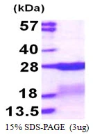 3microg Human RPS7 protein (GTX67776-pro) by SDS-PAGE under reducing condition and visualized by coomassie blue stain. 3microg Human RPS7 protein (GTX67776-pro) by SDS-PAGE under reducing condition and visualized by coomassie blue stain.