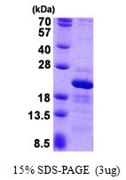 3microg Human RPS10 protein (GTX67777-pro) by SDS-PAGE under reducing condition and visualized by coomassie blue stain. 3microg Human RPS10 protein (GTX67777-pro) by SDS-PAGE under reducing condition and visualized by coomassie blue stain.
