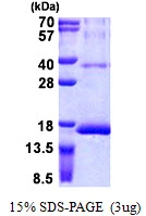 3microg Human RPS12 protein (GTX67778-pro) by SDS-PAGE under reducing condition and visualized by coomassie blue stain. 3microg Human RPS12 protein (GTX67778-pro) by SDS-PAGE under reducing condition and visualized by coomassie blue stain.