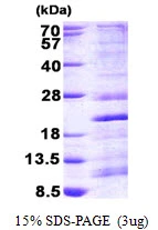3microg Human RPS13 protein (GTX67779-pro) by SDS-PAGE under reducing condition and visualized by coomassie blue stain. 3microg Human RPS13 protein (GTX67779-pro) by SDS-PAGE under reducing condition and visualized by coomassie blue stain.