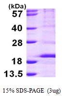 3microg Human RPS14 protein (GTX67780-pro) by SDS-PAGE under reducing condition and visualized by coomassie blue stain. 3microg Human RPS14 protein (GTX67780-pro) by SDS-PAGE under reducing condition and visualized by coomassie blue stain.