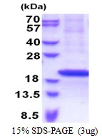 3microg Human RPS18 protein (GTX67782-pro) by SDS-PAGE under reducing condition and visualized by coomassie blue stain. 3microg Human RPS18 protein (GTX67782-pro) by SDS-PAGE under reducing condition and visualized by coomassie blue stain.