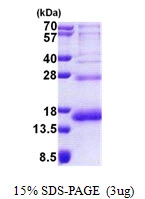 3microg Human RPS19 protein (GTX67783-pro) by SDS-PAGE under reducing condition and visualized by coomassie blue stain. 3microg Human RPS19 protein (GTX67783-pro) by SDS-PAGE under reducing condition and visualized by coomassie blue stain.
