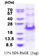 3microg Human RPS20 protein (GTX67784-pro) by SDS-PAGE under reducing condition and visualized by coomassie blue stain. 3microg Human RPS20 protein (GTX67784-pro) by SDS-PAGE under reducing condition and visualized by coomassie blue stain.