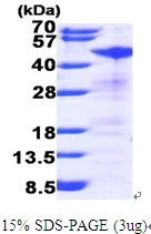 3microg Human RRM2 protein (GTX67786-pro) by SDS-PAGE under reducing condition and visualized by coomassie blue stain. 3microg Human RRM2 protein (GTX67786-pro) by SDS-PAGE under reducing condition and visualized by coomassie blue stain.