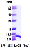3microg Human S100A6 protein (GTX67791-pro) by SDS-PAGE under reducing condition and visualized by coomassie blue stain. 3microg Human S100A6 protein (GTX67791-pro) by SDS-PAGE under reducing condition and visualized by coomassie blue stain.