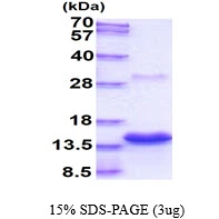 3microg Human Psoriasin protein (GTX67792-pro) by SDS-PAGE under reducing condition and visualized by coomassie blue stain.