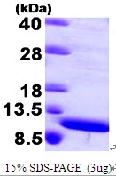3microg Human S100A8 protein (GTX67793-pro) by SDS-PAGE under reducing condition and visualized by coomassie blue stain.
