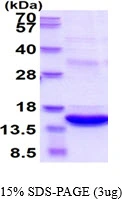3microg Human S100A8 protein (GTX67794-pro) by SDS-PAGE under reducing condition and visualized by coomassie blue stain. 3microg Human S100A8 protein (GTX67794-pro) by SDS-PAGE under reducing condition and visualized by coomassie blue stain.