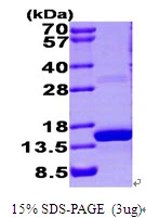 3microg Human S100A9 protein (GTX67795-pro) by SDS-PAGE under reducing condition and visualized by coomassie blue stain. 3microg Human S100A9 protein (GTX67795-pro) by SDS-PAGE under reducing condition and visualized by coomassie blue stain.