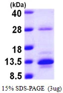 3microg Human S100A10 protein (GTX67796-pro) by SDS-PAGE under reducing condition and visualized by coomassie blue stain. 3microg Human S100A10 protein (GTX67796-pro) by SDS-PAGE under reducing condition and visualized by coomassie blue stain.