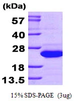 3microg Human SAT1 protein (GTX67804-pro) by SDS-PAGE under reducing condition and visualized by coomassie blue stain. 3microg Human SAT1 protein (GTX67804-pro) by SDS-PAGE under reducing condition and visualized by coomassie blue stain.