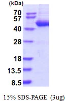 3microg Human SERPINB4 protein (GTX67806-pro) by SDS-PAGE under reducing condition and visualized by coomassie blue stain. 3microg Human SERPINB4 protein (GTX67806-pro) by SDS-PAGE under reducing condition and visualized by coomassie blue stain.