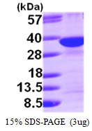 3microg Human Syntenin 1 protein (GTX67807-pro) by SDS-PAGE under reducing condition and visualized by coomassie blue stain. 3microg Human Syntenin 1 protein (GTX67807-pro) by SDS-PAGE under reducing condition and visualized by coomassie blue stain.