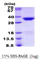 3microg Human SF2 protein (GTX67812-pro) by SDS-PAGE under reducing condition and visualized by coomassie blue stain. 3microg Human SF2 protein (GTX67812-pro) by SDS-PAGE under reducing condition and visualized by coomassie blue stain.