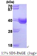 3microg Human SGTA protein (GTX67814-pro) by SDS-PAGE under reducing condition and visualized by coomassie blue stain. 3microg Human SGTA protein (GTX67814-pro) by SDS-PAGE under reducing condition and visualized by coomassie blue stain.