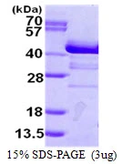 3microg Human SH3GL2 protein (GTX67816-pro) by SDS-PAGE under reducing condition and visualized by coomassie blue stain. 3microg Human SH3GL2 protein (GTX67816-pro) by SDS-PAGE under reducing condition and visualized by coomassie blue stain.