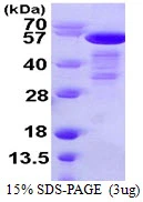 3microg Human SHC1 protein (GTX67818-pro) by SDS-PAGE under reducing condition and visualized by coomassie blue stain. 3microg Human SHC1 protein (GTX67818-pro) by SDS-PAGE under reducing condition and visualized by coomassie blue stain.