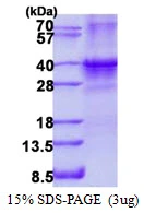 3microg Human SIX1 protein (GTX67820-pro) by SDS-PAGE under reducing condition and visualized by coomassie blue stain. 3microg Human SIX1 protein (GTX67820-pro) by SDS-PAGE under reducing condition and visualized by coomassie blue stain.