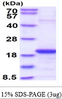 3microg Human SKP1 protein (GTX67821-pro) by SDS-PAGE under reducing condition and visualized by coomassie blue stain. 3microg Human SKP1 protein (GTX67821-pro) by SDS-PAGE under reducing condition and visualized by coomassie blue stain.