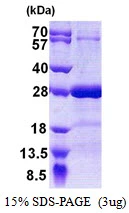 3microg Human SNAP25 protein (GTX67825-pro) by SDS-PAGE under reducing condition and visualized by coomassie blue stain. 3microg Human SNAP25 protein (GTX67825-pro) by SDS-PAGE under reducing condition and visualized by coomassie blue stain.