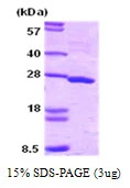 3microg Human SNAP25 protein (GTX67826-pro) by SDS-PAGE under reducing condition and visualized by coomassie blue stain. 3microg Human SNAP25 protein (GTX67826-pro) by SDS-PAGE under reducing condition and visualized by coomassie blue stain.