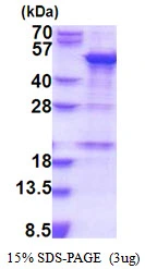 3microg Human SNAP43 protein (GTX67827-pro) by SDS-PAGE under reducing condition and visualized by coomassie blue stain. 3microg Human SNAP43 protein (GTX67827-pro) by SDS-PAGE under reducing condition and visualized by coomassie blue stain.
