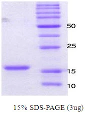3microg Human alpha Synuclein protein (GTX67829-pro) by SDS-PAGE under reducing condition and visualized by coomassie blue stain. 3microg Human alpha Synuclein protein (GTX67829-pro) by SDS-PAGE under reducing condition and visualized by coomassie blue stain.