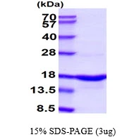 3microg Human alpha Synuclein protein (GTX67830-pro) by SDS-PAGE under reducing condition and visualized by coomassie blue stain.