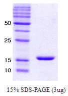 3microg Human alpha Synuclein protein (GTX67832-pro) by SDS-PAGE under reducing condition and visualized by coomassie blue stain. 3microg Human alpha Synuclein protein (GTX67832-pro) by SDS-PAGE under reducing condition and visualized by coomassie blue stain.