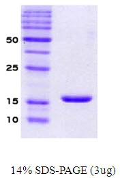 3microg Human alpha Synuclein protein (GTX67833-pro) by SDS-PAGE under reducing condition and visualized by coomassie blue stain. 3microg Human alpha Synuclein protein (GTX67833-pro) by SDS-PAGE under reducing condition and visualized by coomassie blue stain.