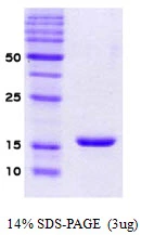 3microg Human alpha Synuclein protein (GTX67834-pro) by SDS-PAGE under reducing condition and visualized by coomassie blue stain. 3microg Human alpha Synuclein protein (GTX67834-pro) by SDS-PAGE under reducing condition and visualized by coomassie blue stain.