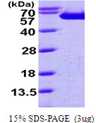 3microg Human Fascin 1 protein (GTX67836-pro) by SDS-PAGE under reducing condition and visualized by coomassie blue stain. 3microg Human Fascin 1 protein (GTX67836-pro) by SDS-PAGE under reducing condition and visualized by coomassie blue stain.
