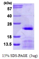 3microg Human SNRPC protein (GTX67839-pro) by SDS-PAGE under reducing condition and visualized by coomassie blue stain. 3microg Human SNRPC protein (GTX67839-pro) by SDS-PAGE under reducing condition and visualized by coomassie blue stain.