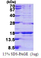 3microg Human SNRPD3 protein (GTX67841-pro) by SDS-PAGE under reducing condition and visualized by coomassie blue stain. 3microg Human SNRPD3 protein (GTX67841-pro) by SDS-PAGE under reducing condition and visualized by coomassie blue stain.