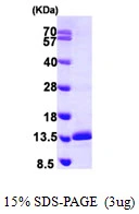 3microg Human SNRPE protein (GTX67842-pro) by SDS-PAGE under reducing condition and visualized by coomassie blue stain. 3microg Human SNRPE protein (GTX67842-pro) by SDS-PAGE under reducing condition and visualized by coomassie blue stain.