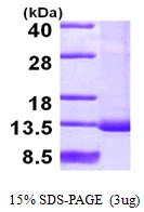 3microg Human SNRPF protein (GTX67843-pro) by SDS-PAGE under reducing condition and visualized by coomassie blue stain. 3microg Human SNRPF protein (GTX67843-pro) by SDS-PAGE under reducing condition and visualized by coomassie blue stain.