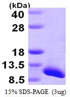3microg Human SNRPG protein (GTX67844-pro) by SDS-PAGE under reducing condition and visualized by coomassie blue stain. 3microg Human SNRPG protein (GTX67844-pro) by SDS-PAGE under reducing condition and visualized by coomassie blue stain.