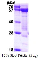 3microg Human Syntrophin alpha 1 protein (GTX67845-pro) by SDS-PAGE under reducing condition and visualized by coomassie blue stain. 3microg Human Syntrophin alpha 1 protein (GTX67845-pro) by SDS-PAGE under reducing condition and visualized by coomassie blue stain.