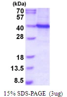 3microg Human PU.1 protein (GTX67846-pro) by SDS-PAGE under reducing condition and visualized by coomassie blue stain. 3microg Human PU.1 protein (GTX67846-pro) by SDS-PAGE under reducing condition and visualized by coomassie blue stain.